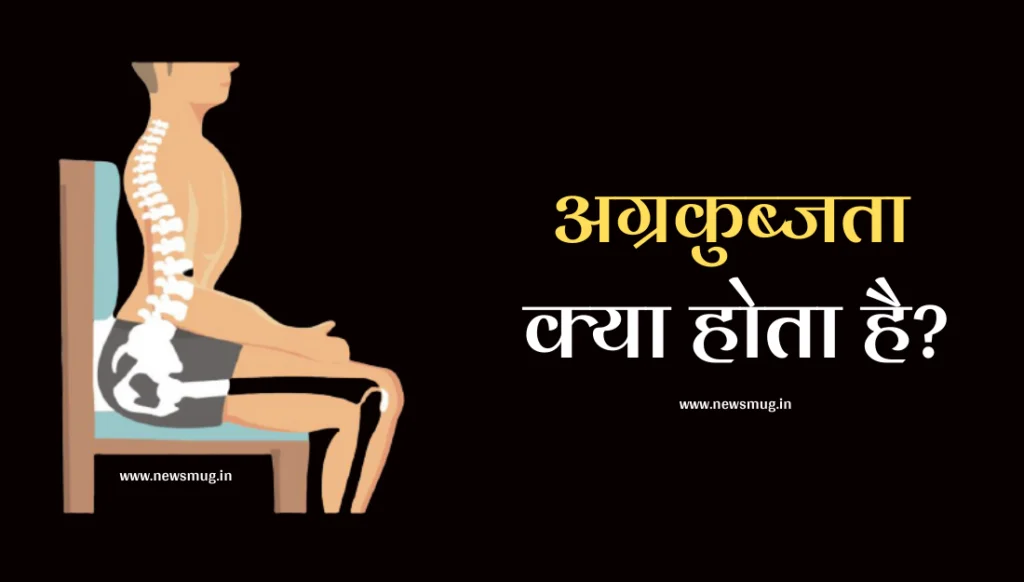 अग्रकुब्जता (Lordosis) क्या होता है? इसके लक्षण, उपाय व व्यायाम what-is-the-meaning-of-lordosis-in-hindi