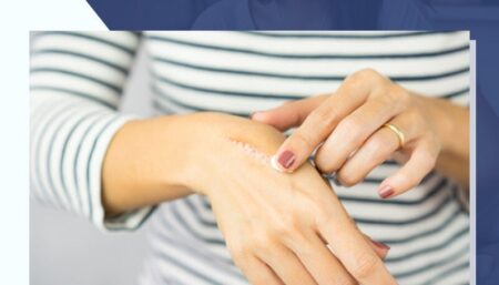 Skin Burn – त्वचा के जल जानें पर तुरंत अपनाएं ये तरीके how-to-get-rid-of-a-blister-and-know-about-skin-burn-home-remedies-in-hindi