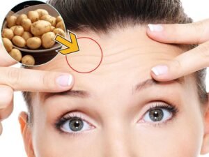 face-wrinkles-home-remedies