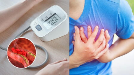 increased-cholesterol-8-indicators