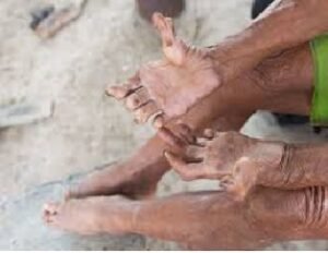 disease-name-in-sanskrit-and-hindi
