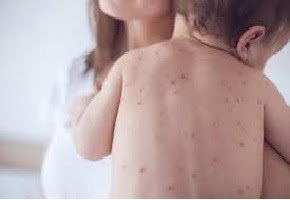 disease-name-in-sanskrit-and-hindi