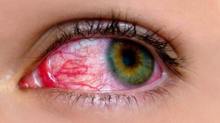 black-fungal-disease-infection-hindi