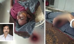 rat-gnawed-dead-body-in-indore