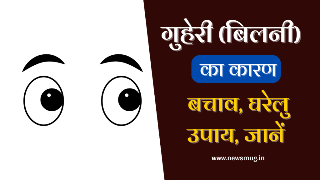 stye-eye-guheri-causes-treatment-in-hindi