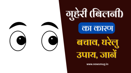stye-eye-guheri-causes-treatment-in-hindi