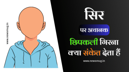 chipkali-sir-par-girne-se-kya-hota-hai