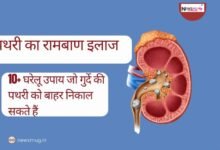 पथरी का रामबाण इलाज