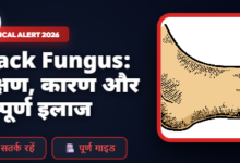 Black Fungus Disease Infection in Hindi